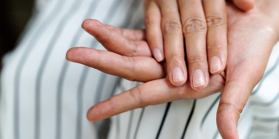 Causes of brittle nails and how to take care of them | Vinmec